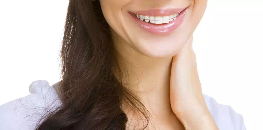 THE MOST AFFORDABLE BRACES IN ORANGE COUNTY